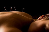 Dr. Charles Fino acupuncture Palos Heights